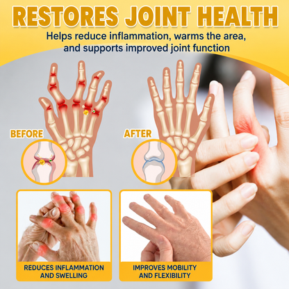 💎TLOPA® Botulinum Toxin and Bee Venom Pain-Relieving and Bone-Healing Ointment🐝 🔥(Especially for seniors & recommended by orthopedists)🦴
