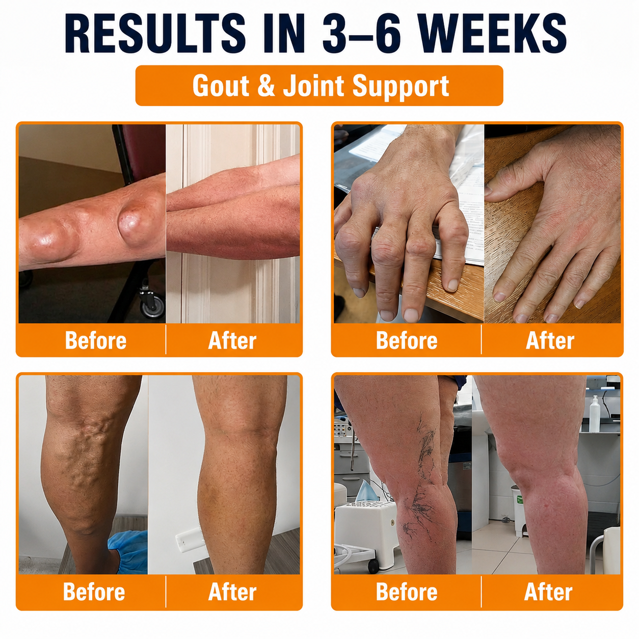 💎TLOPA® Botulinum Toxin and Bee Venom Pain-Relieving and Bone-Healing Ointment🐝 🔥(Especially for seniors & recommended by orthopedists)🦴