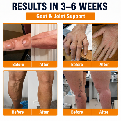 💎TLOPA® Botulinum Toxin and Bee Venom Pain-Relieving and Bone-Healing Ointment🐝 🔥(Especially for seniors & recommended by orthopedists)🦴