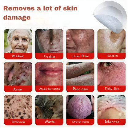 Plant-based wart and mole removal patches