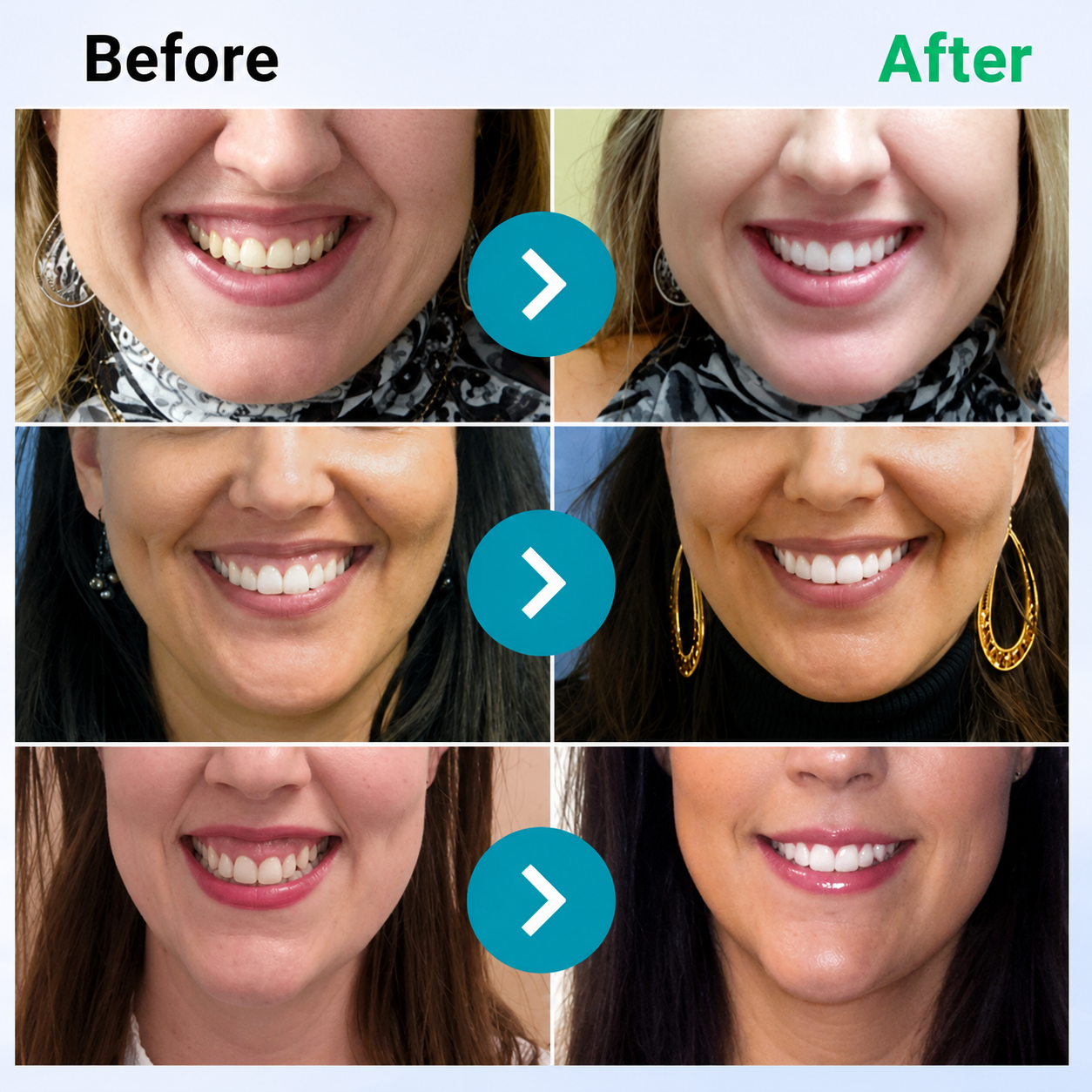 Hormonra® 𝑭𝒐𝒄𝒖𝒔𝒔𝒎𝒊𝒍𝒆 – Oral care powder containing bee venom 🦷🦷