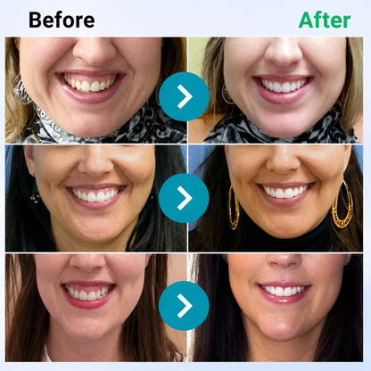Hormonra® 𝑭𝒐𝒄𝒖𝒔𝒔𝒎𝒊𝒍𝒆 – Oral care powder containing bee venom 🦷🦷