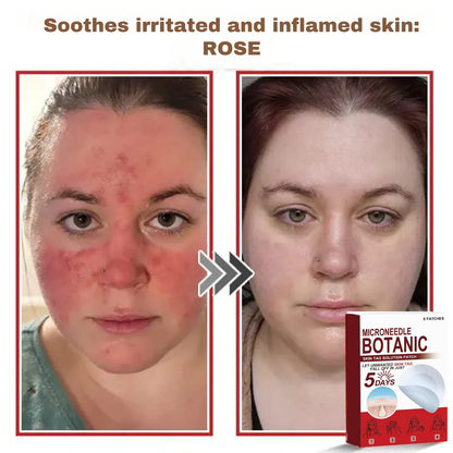 Plant-based wart and mole removal patches