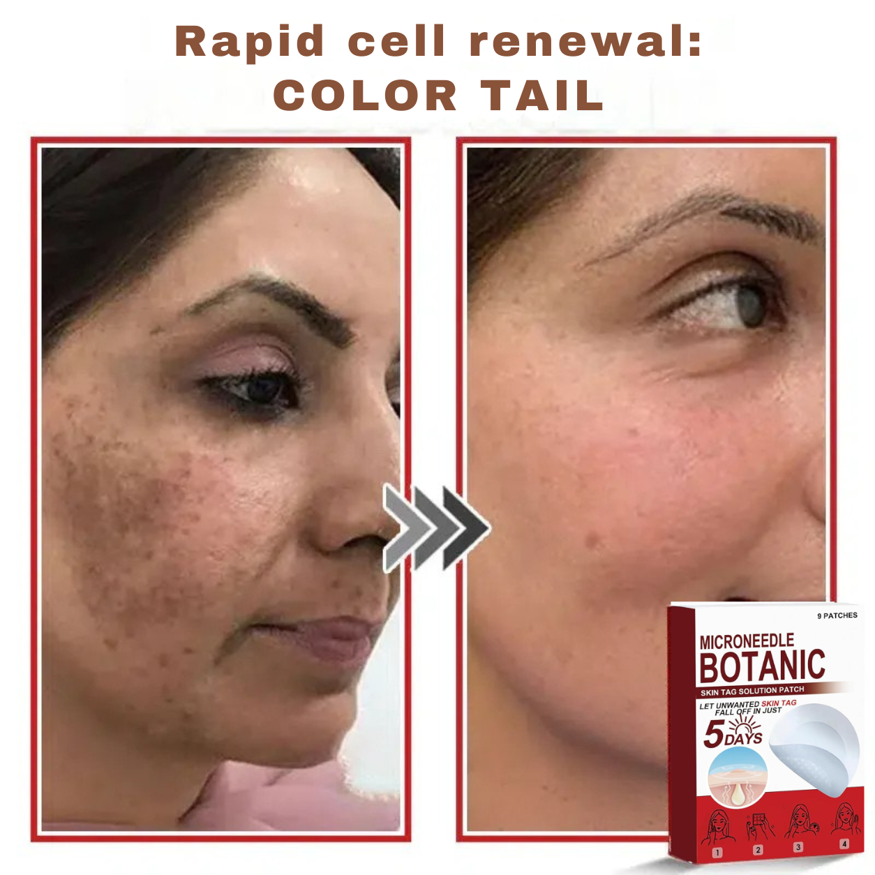 Plant-based wart and mole removal patches
