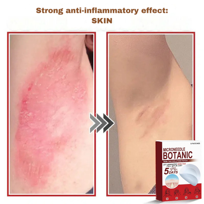 Plant-based wart and mole removal patches