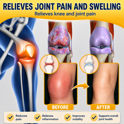 💎TLOPA® Botulinum Toxin and Bee Venom Pain-Relieving and Bone-Healing Ointment🐝 🔥(Especially for seniors & recommended by orthopedists)🦴